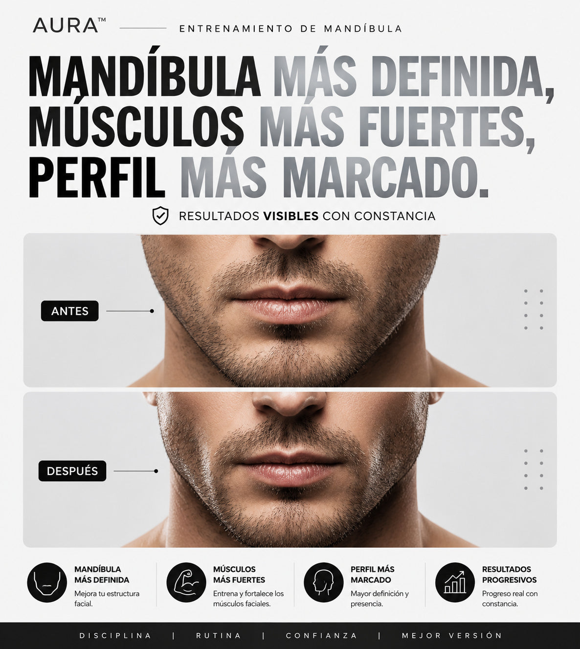 AURA Mandíbula Elite™