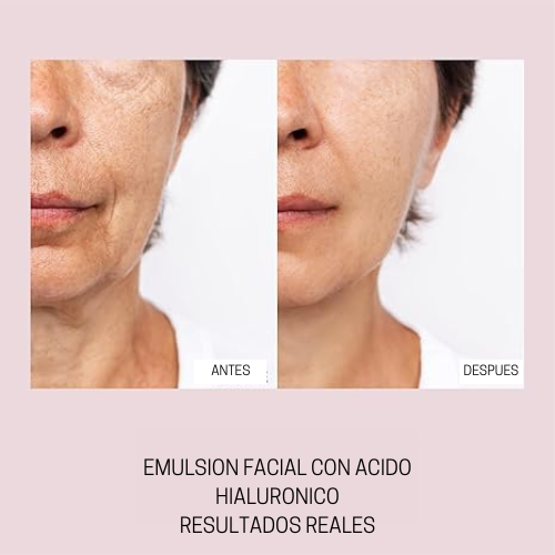 2X1 Crema Anti Ojeras