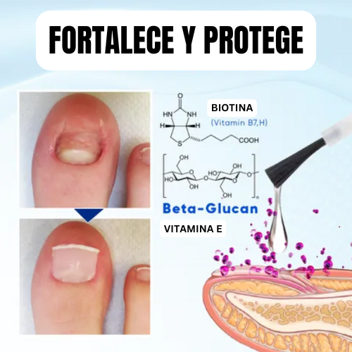 VivaRaíz - Repara uñas