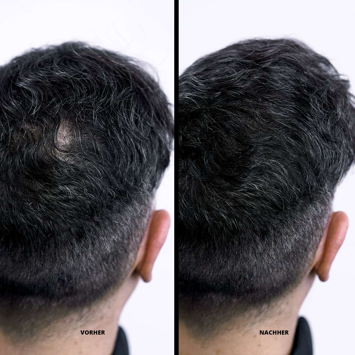 Fibras CABELL™ 2X1